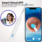 👂✨ Wireless Earwax Removal Tool Kit with 1080P Camera 😲