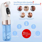 Blackhead Remover